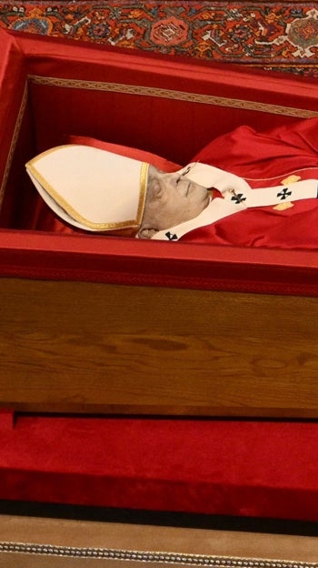 El hematoma de Francisco