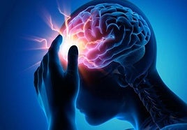 Víctor Espuig, médico de familia, indica cómo detectar un ictus con tres simples gestos: «Cada minuto sin atención puede significar la pérdida de millones de neuronas»