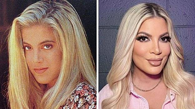 Tori Spelling, antes y después