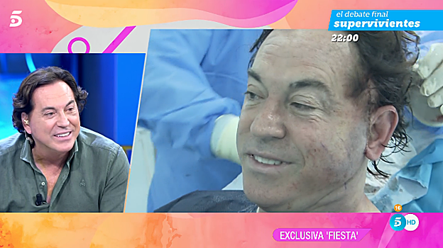 Pipi Estrada muestra el proceso de su operación de reducción de papada