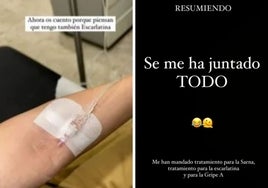 Una exconcursante de 'La Isla de las Tentaciones', obligada a ir a urgencias por un cuadro de sarna, escarlatina y Gripe A