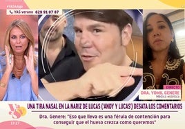 Experta en medicina estética aclara para qué es el comentado apósito que luce Lucas en la nariz