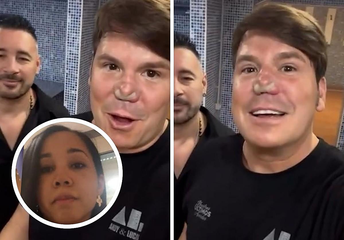 La doctora Yomil Genere explica qué es lo que se ha puesto Lucas, de Andy y Lucas, en su nariz: «Es un cambio estructural tras una cirugía»