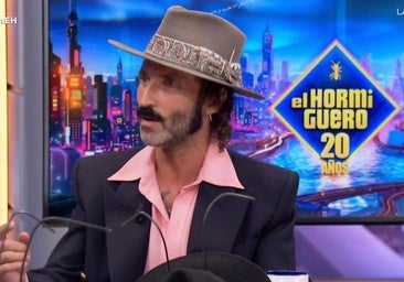 Leiva narra el accidente en el que perdió el ojo a los 12 años: «Me dispararon con una pistola»