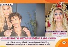 Marcela Iglesias, la 'Barbie humana': «Me transfieren plasma de mi hijo para regenerar mis células más rápido»