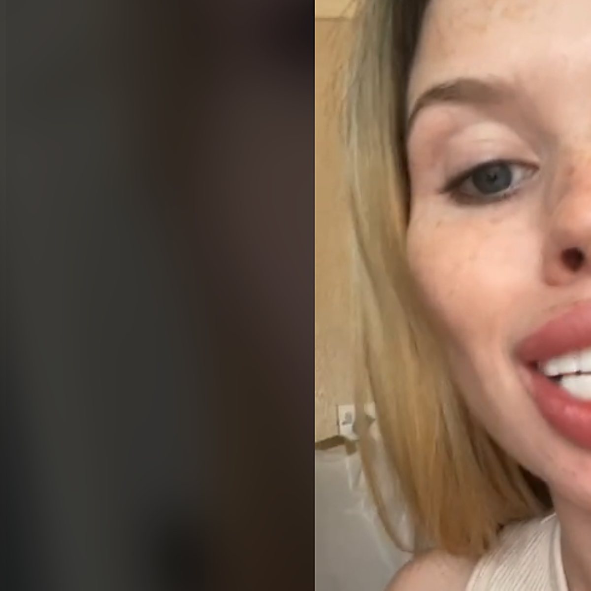 200€ por la «sonrisa perfecta» y termina con la boca de «un caballo»