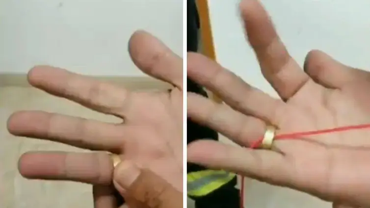 El truco de los bomberos para quitar un anillo atascado en el dedo