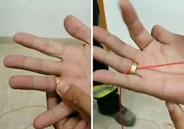 El truco de los bomberos para quitar un anillo atascado en el dedo