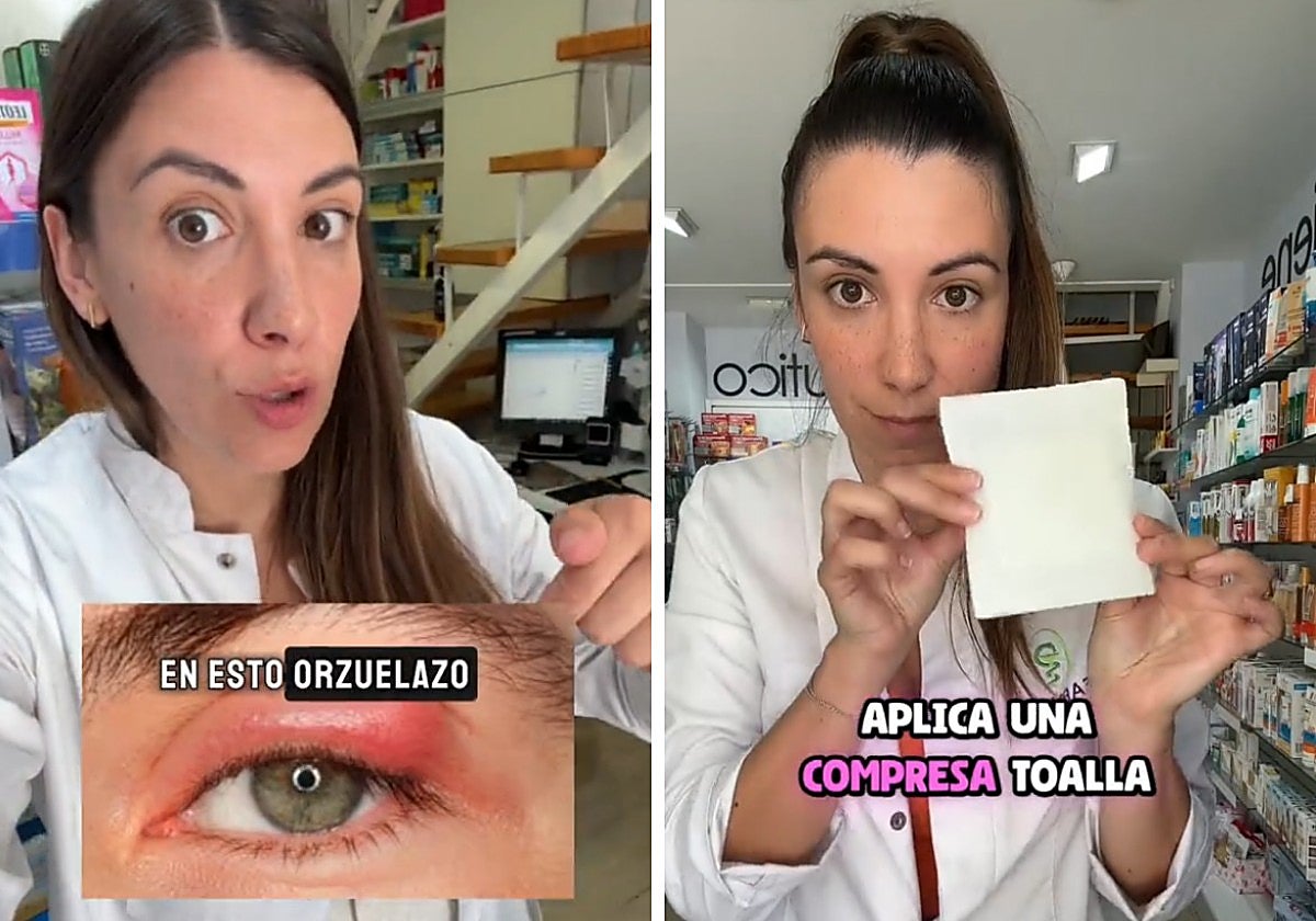 Los orzuelos son una molestia ocular frecuente que muchos han experimentado en algún momento de sus vidas