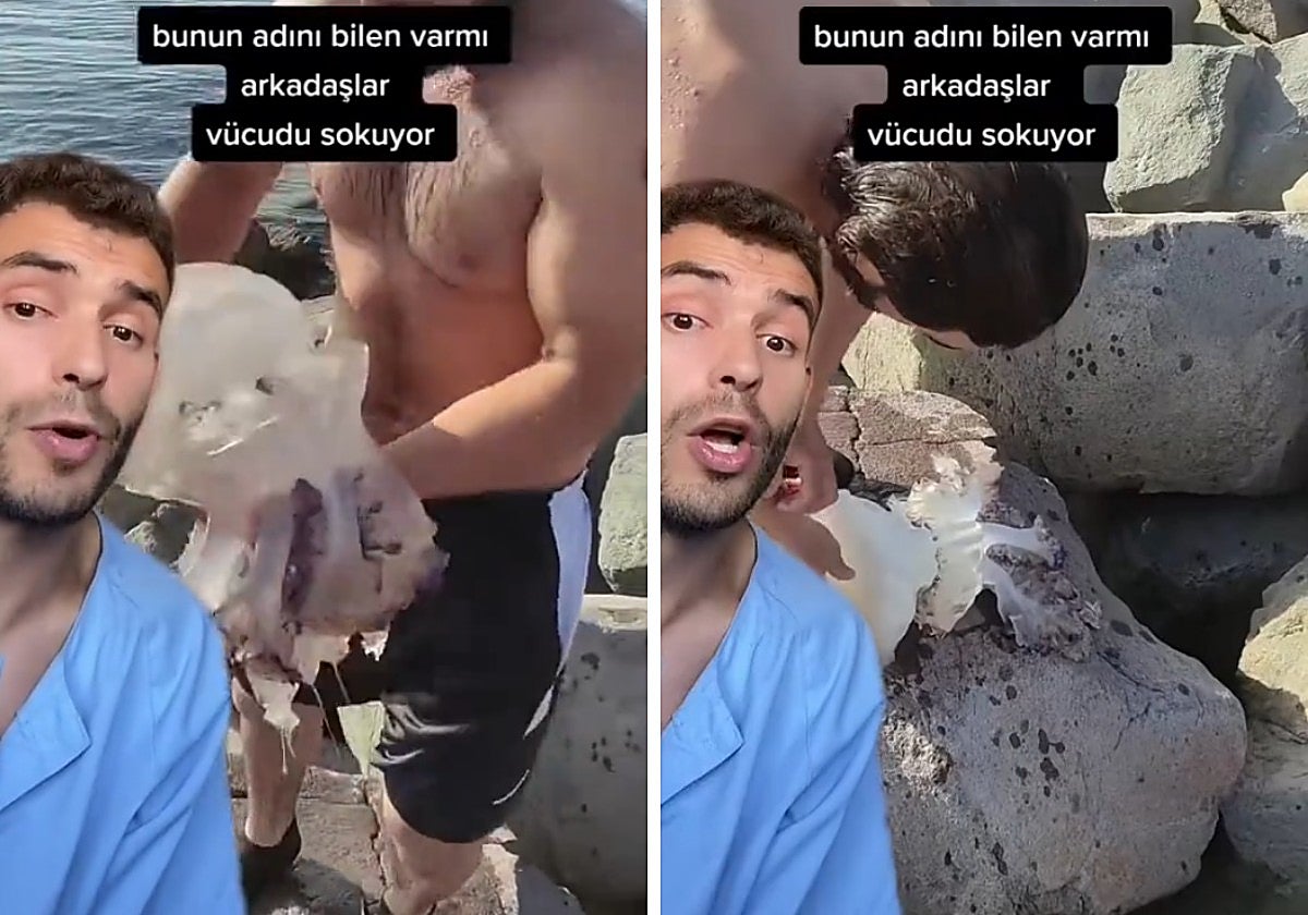 El enfermero dio varios consejos para tratar la picadura de una medusa