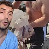 Un enfermero avisa sobre qué no hacer si vemos una medusa muerta en la playa