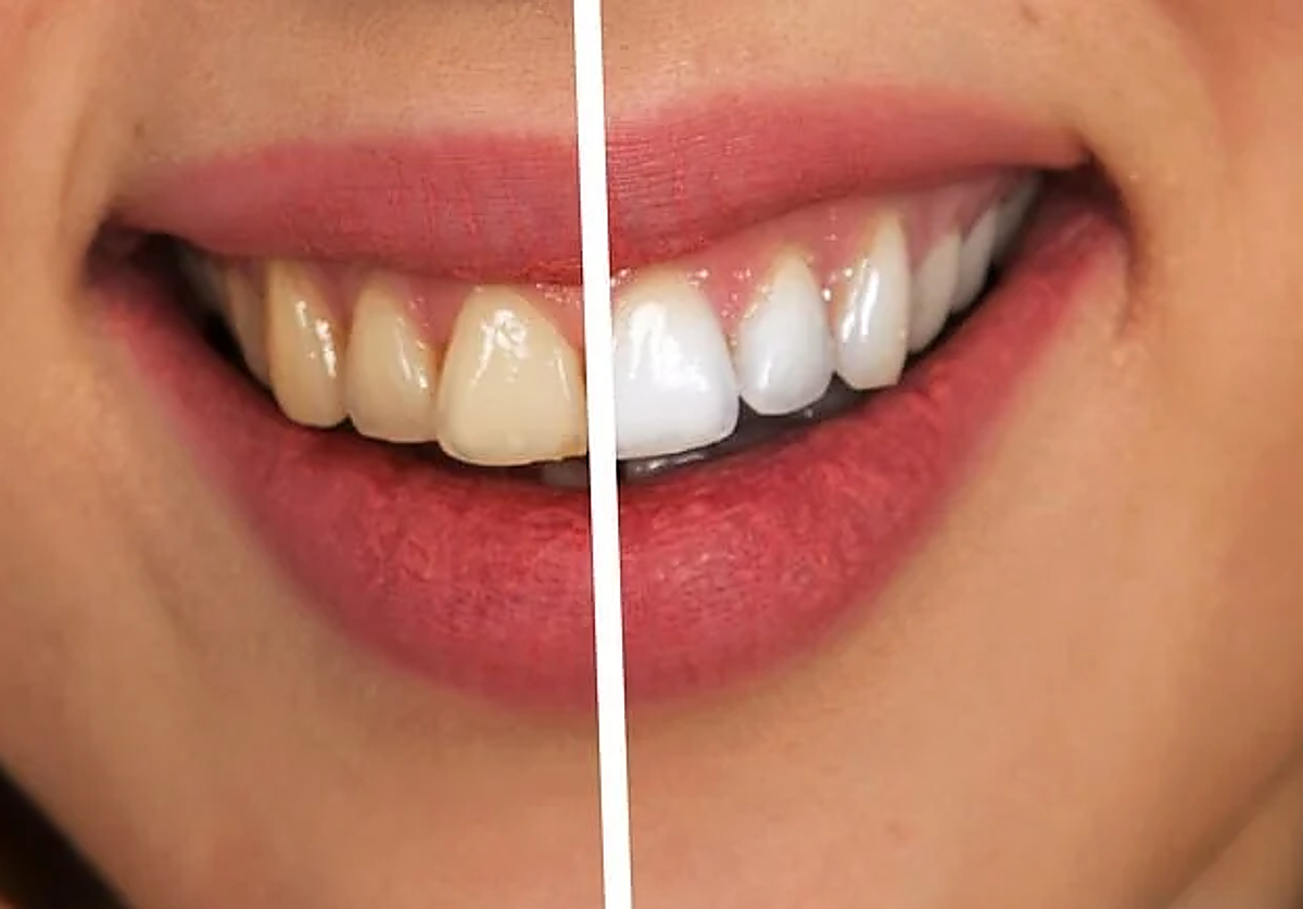 El error más común al lavarse los dientes