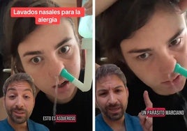 Un farmacéutico explica el efecto de los lavados nasales sobre las personas con alergia: «¿Es peligroso?»