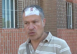 El propietario de un inmueble denuncia una brutal agresión por parte de sus okupas: «No me han matado de milagro»