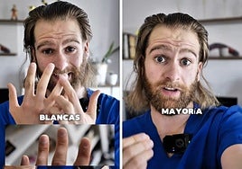 Un podólogo advierte sobre la verdadera causa de la aparición de manchas blancas en las uñas:  «Se llama leuconiquia»