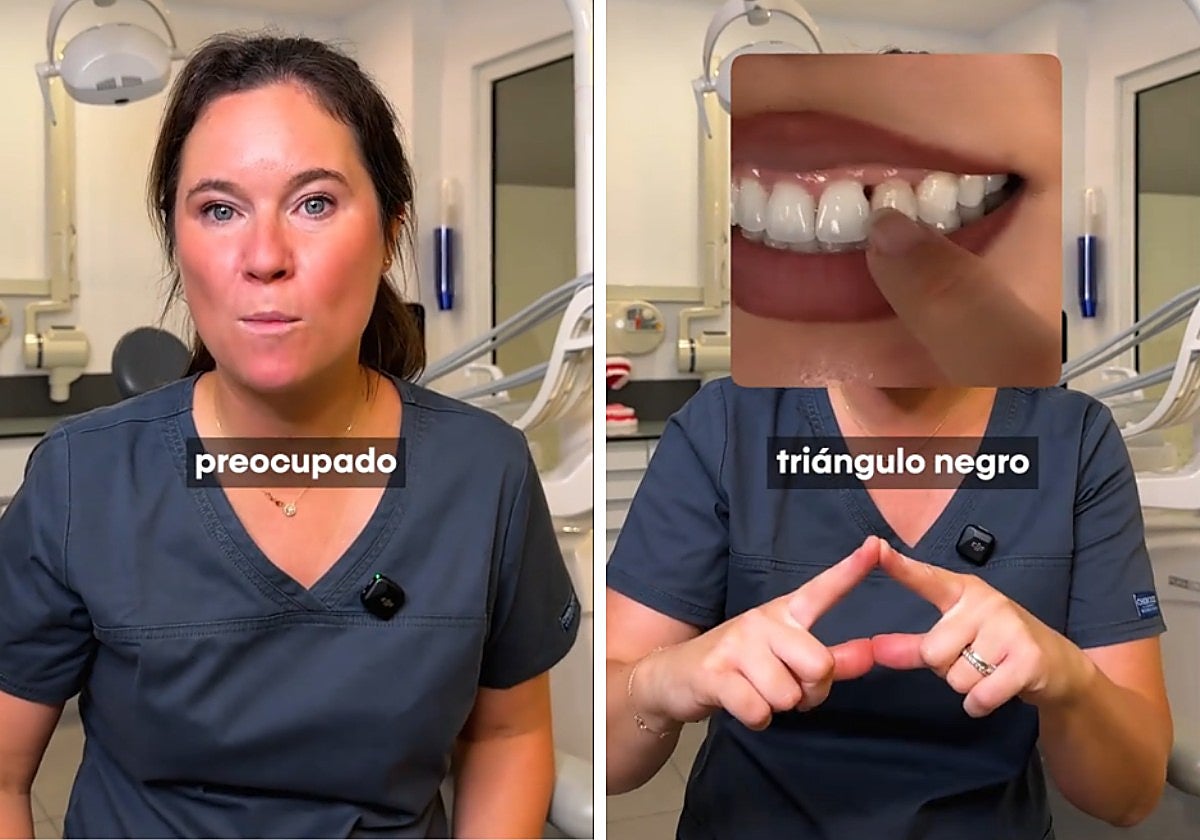 Una ortodoncista explica qué son los agujeros entre los dientes: «Podemos perder alguna pieza»