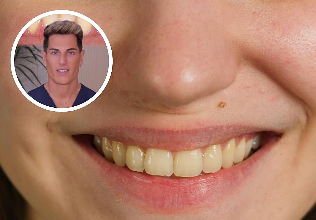 Un odontólogo explica por qué los dientes pueden verse amarillos incluso si se cepillan correctamente: «No es falta de higiene»