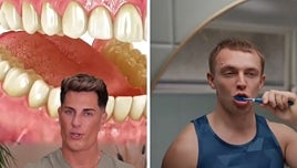 Un odontólogo señala qué pasa cuando no te lavas los dientes: «El nocturno es más importante que el de la mañana»