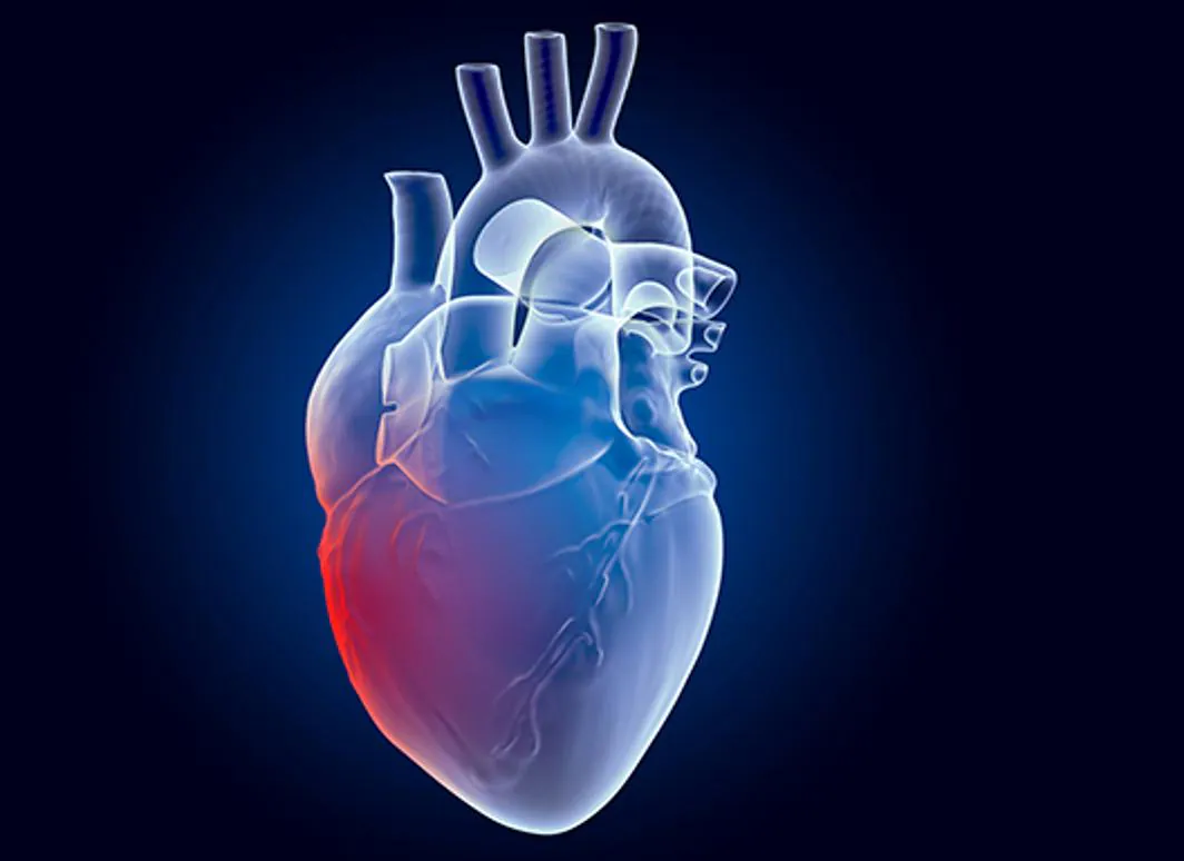 La autoinmunidad, un nuevo factor de riesgo cardiovascular