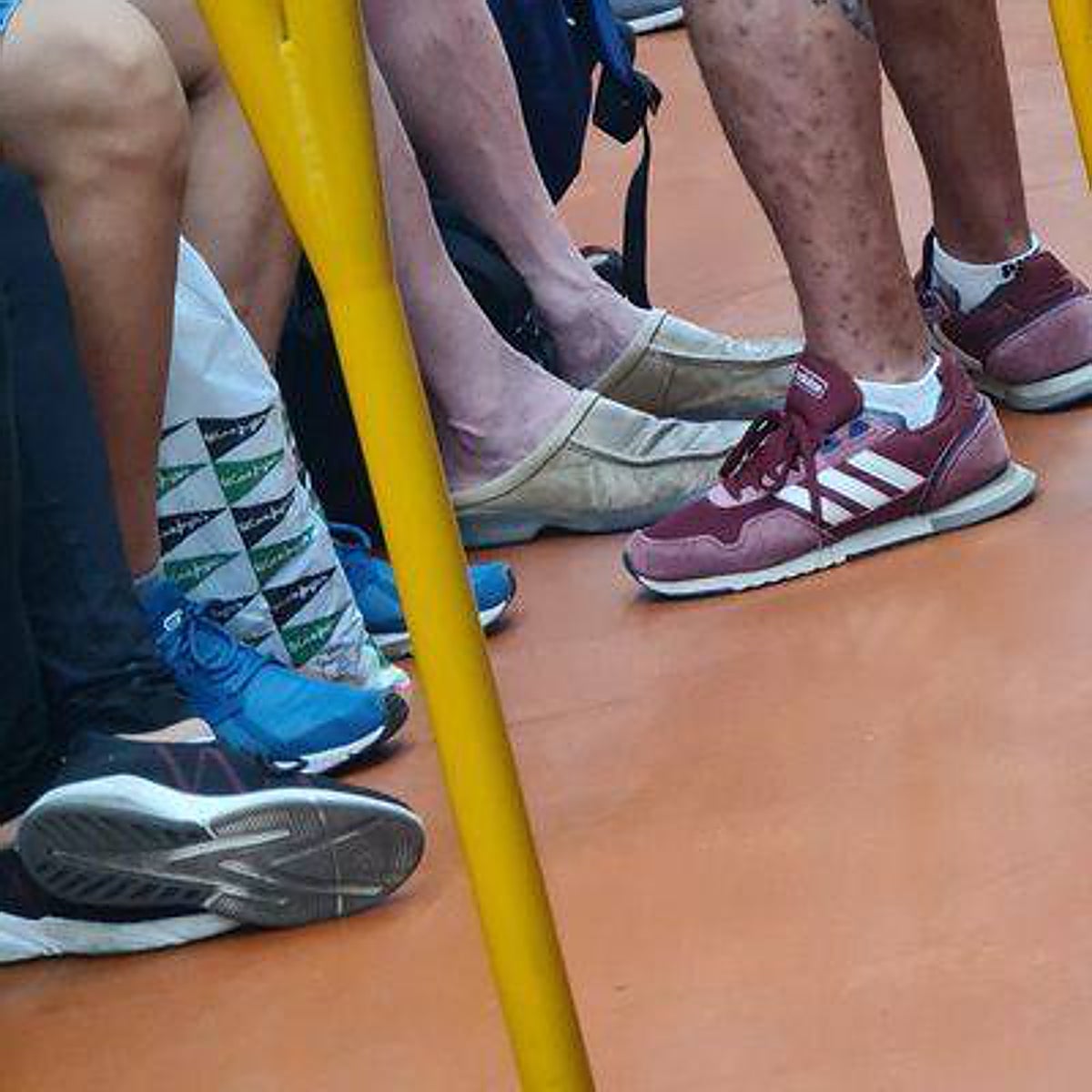 Neurofibromatosis: la enfermedad que se confunde con la viruela del mono