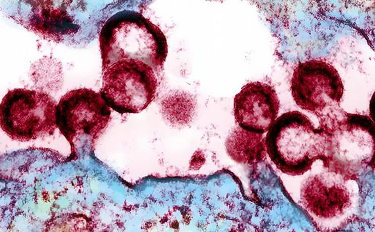Un nuevo virus semejante al VIH «está preparado para infectar» a los humanos