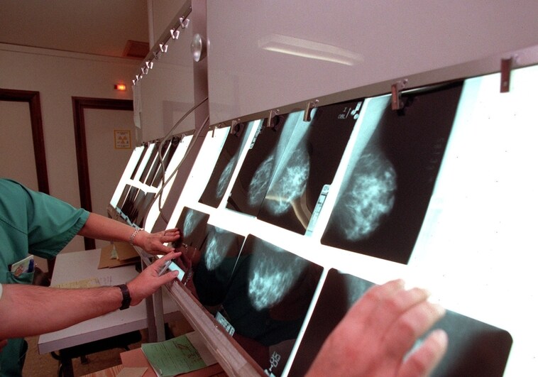Investigadores españoles crean un modelo para predecir el riesgo individual de cáncer de mama