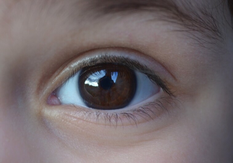 Identifican una nueva mutación genética en el glaucoma infantil