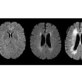El cambio de hábitos puede ralentizar el envejecimiento cerebral