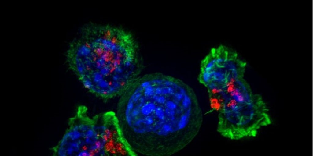 Un proyecto en español diseña gemelos virtuales para tratar a niños con leucemia Un proyecto en español diseña gemelos virtuales para tratar a niños con leucemia