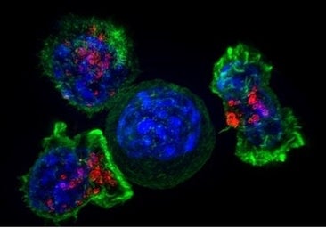 Un fármaco experimental controla la leucemia más resistente en 18 pacientes