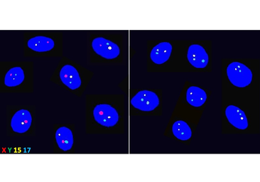 Esta técnica permite elegir el sexo del bebé con un 80% de éxito