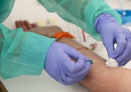 Primer test de sangre que predice si vas a tener un cáncer de colon