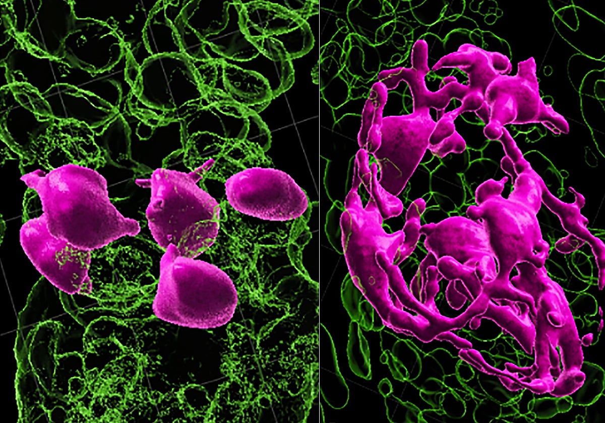 Las células madre que tiñen el cabello (a la izquierda, en rosa) deben estar en el compartimento del germen del cabello para activarse (a la derecha) y convertirse en pigmento