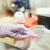 El trasplante fecal supera a los antibióticos en las infecciones bacterianas