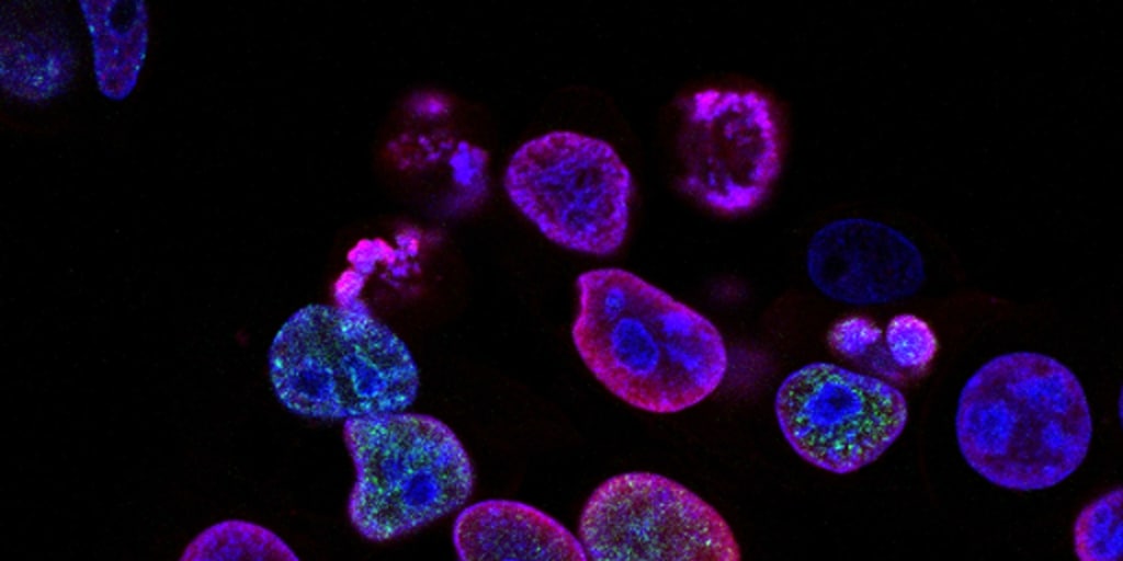 This is how breast cancer tricks the immune system to grow