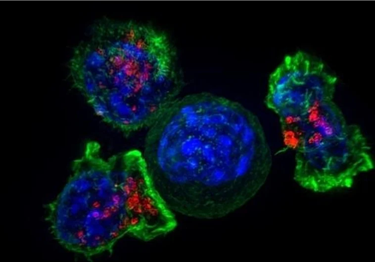 Cáncer de ovario Cell-cancer-RzOMf5xqhA5OLuBRCVRFmtK-758x531@abc