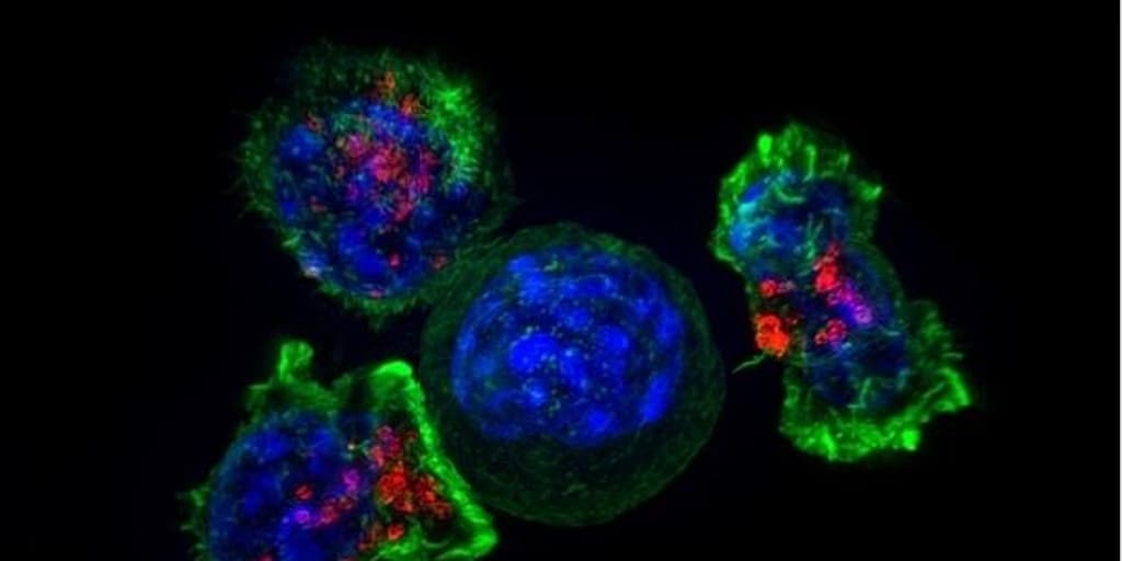 Una nueva combinación de terapias retrasa el avance del cáncer de ovario