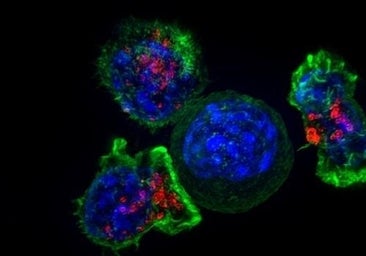 Una nueva combinación de terapias retrasa el avance del cáncer de ovario