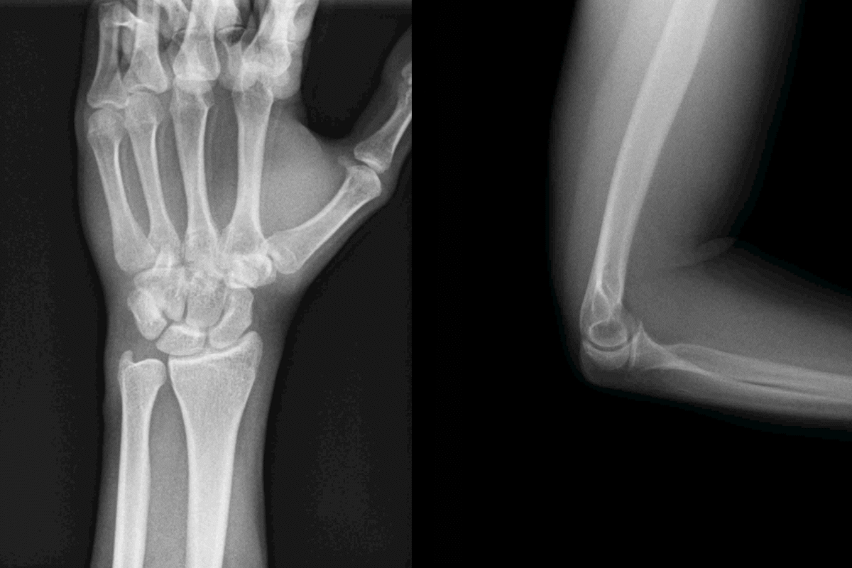 Radiografía digital dinámica, más precisa en el diagnóstico gracias a las imágenes en movimiento