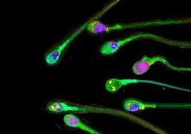 ¿Disminuye la calidad del semen tras sufrir una infección por covid?