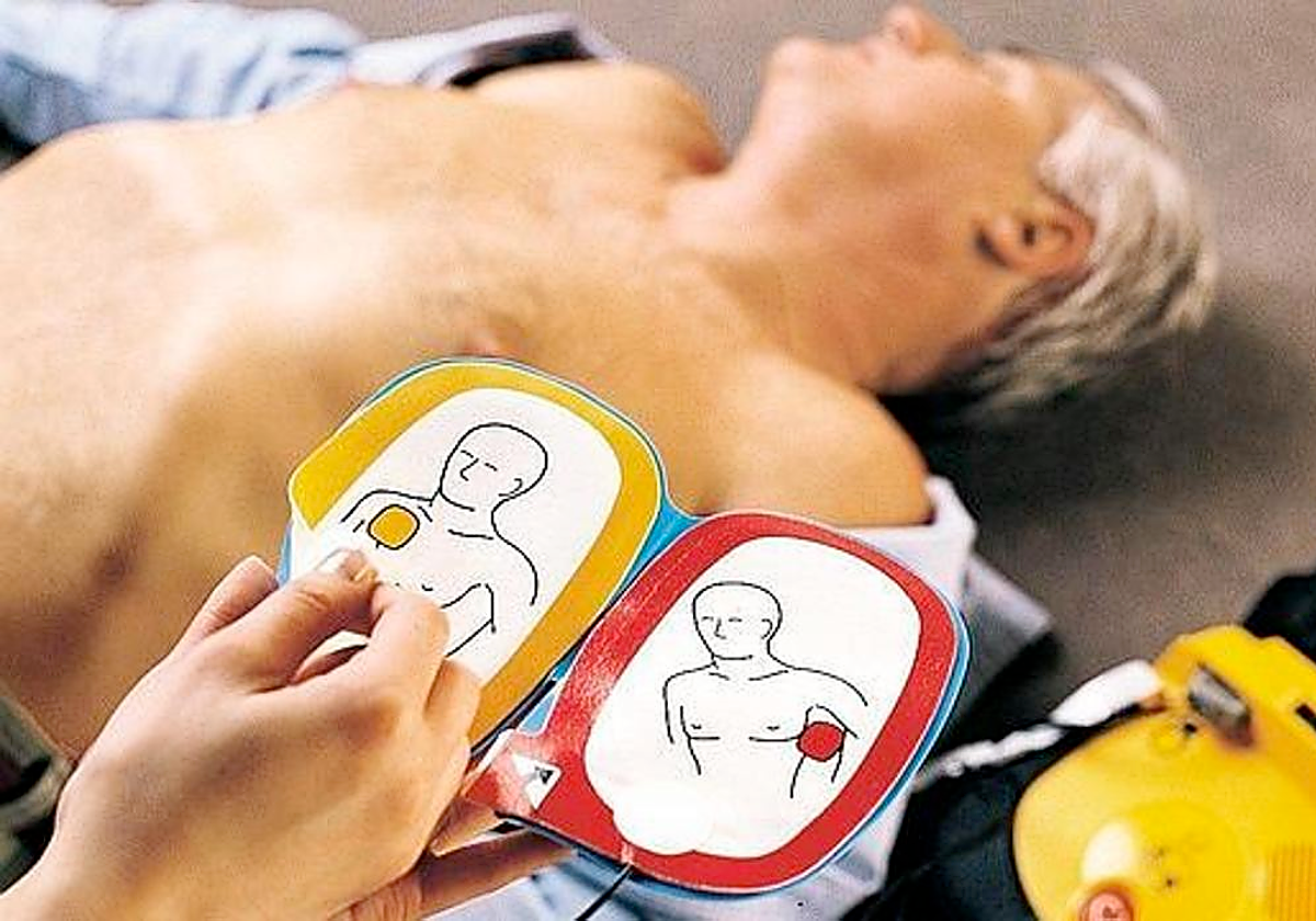 Ante un infarto, es vital actuar rápido y mantener siempre la calma