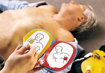 Por qué es tan importante reconocer los síntomas de un infarto