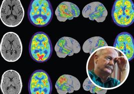 Rafael Yuste:  «Podemos cambiar la actividad cerebral, ya no es ciencia ficción»﻿