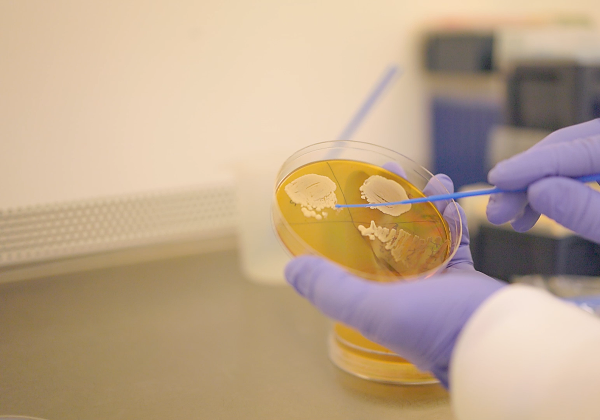 Colonia de levaduras