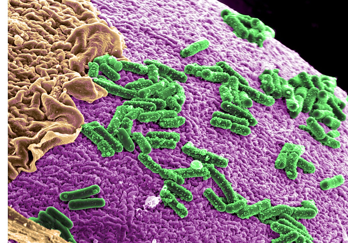 Bacterias intestinales
