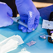 A más covid, más casos de diabetes tipo 1, pero nadie sabe por qué