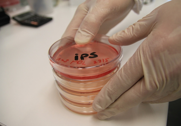 La medicina regenerativa basada en células madre, esperanza para curar la EPOC