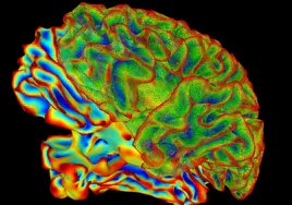 El primer atlas del cerebro humano explica qué nos hace humanos