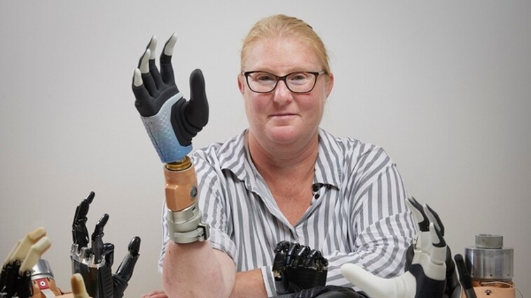 La mano biónica que siente al fusionarse con el esqueleto y los nervios