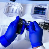 Vinculan los niveles elevados de insulina con el riesgo de cáncer de páncreas